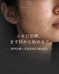 ニキビ治療、まず何から始める？